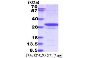 SDS-PAGE (SDS) image for Glycyl-tRNA Synthetase (GARS) (AA 43-289) protein (His tag) (ABIN7280733) (GARS Protein (AA 43-289) (His tag))