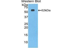 Western Blotting (WB) image for anti-Ribosomal Protein S6 Kinase, 70kDa, Polypeptide 2 (RPS6KB2) (AA 194-453) antibody (ABIN1860472) (RPS6KB2 抗体  (AA 194-453))