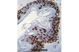 Formalin fixed, paraffin embedded human skin tissue stained with IFI35 Antibody (N-term) followed by peroxidase conjugation of the secondary antibody and DAB staining. (IFI35 抗体  (N-Term))