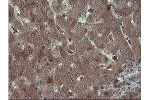 Image no. 1 for anti-Carboxypeptidase A2 (Pancreatic) (CPA2) antibody (ABIN1497598) (Carboxypeptidase A2 抗体)