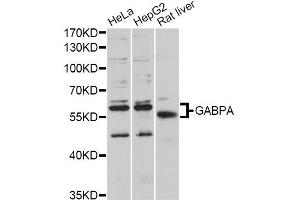 Western blot analysis of extracts of various cell lines, using GABPA antibody (ABIN5997766) at 1/1000 dilution. (GABPA 抗体)