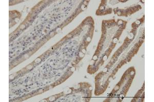 Immunostaining (ISt) image for anti-Casein Kinase 1, gamma 1 (CSNK1G1) (AA 293-393) antibody (ABIN565708)