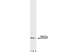 Western Blotting (WB) image for anti-Superoxide Dismutase 1, Soluble (SOD1) antibody (ABIN967513) (SOD1 抗体)