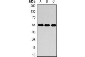 Western blot analysis of Fibrinogen gamma expression in SGC996 (A), mouse liver (B), mouse lung (C) whole cell lysates. (FGG 抗体)