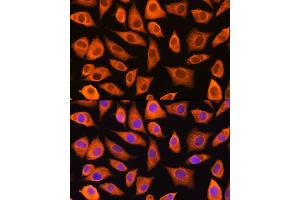Immunofluorescence analysis of L929 cells using L Rabbit pAb (ABIN1680664, ABIN3018314, ABIN3018315 and ABIN6220434) at dilution of 1:100 (40x lens). (LASP1 抗体  (AA 130-205))