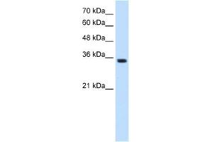 Western Blotting (WB) image for anti-Transient Receptor Potential Cation Channel, Subfamily M, Member 5 (TRPM5) (N-Term) antibody (ABIN630115)