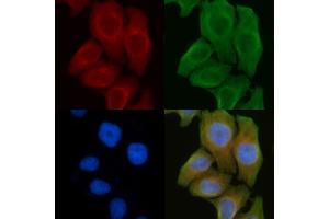 ABIN6261670 and ABIN6272297 staining Hela cells by IF/ICC. (RIMKLB 抗体  (Internal Region))