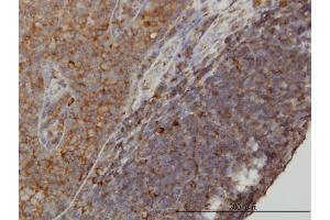 Immunoperoxidase of monoclonal antibody to WDR77 on formalin-fixed paraffin-embedded human tonsil. (WDR77 抗体  (AA 1-342))