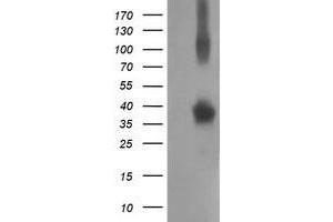 Western Blotting (WB) image for anti-Nonhomologous End-Joining Factor 1 (NHEJ1) antibody (ABIN1499733) (NHEJ1 抗体)