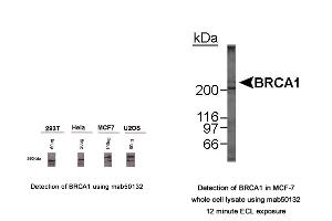 Image no. 3 for anti-Breast Cancer 1 (BRCA1) (AA 1314-1600), (AA 1314-1864) antibody (ABIN363286) (BRCA1 抗体  (AA 1314-1600, AA 1314-1864))