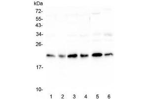 Western blot testing of human 1) HeLa, 2) placenta, 3) HepG2, 4) MCF7, 5) mouse testis and 6) mouse brain lysate with RKIP antibody at 0. (PEBP1 抗体)