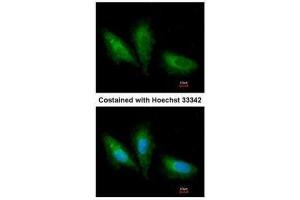 ICC/IF Image Immunofluorescence analysis of paraformaldehyde-fixed A549, using PRKCSH, antibody at 1:200 dilution. (PRKCSH 抗体)