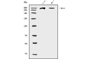 Western blot analysis of BRCA1 using anti-BRCA1 antibody (ABIN7600079).