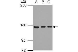 WB Image Sample (30 ug of whole cell lysate) A: 293T B: A431 C: HeLa 5% SDS PAGE antibody diluted at 1:1000 (ITGA9 抗体  (N-Term))