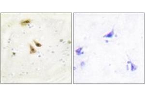 Immunohistochemistry analysis of paraffin-embedded human brain tissue, using UBF1 Antibody. (UBTF 抗体  (AA 501-550))
