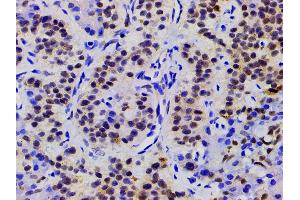 Immunohistochemistry (IHC) image for anti-Cofilin 1 (CFL1) (pSer3) antibody (ABIN6255180)