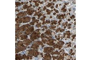 Immunohistochemical staining of human stomach with SLC2A13 polyclonal antibody  shows strong cytoplasmic positivity in glandular cells at 1:20-1:50 dilution. (SLC2A13 抗体)
