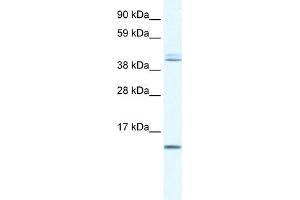 WB Suggested Anti-TSFM Antibody Titration:  0. (TSFM 抗体  (N-Term))