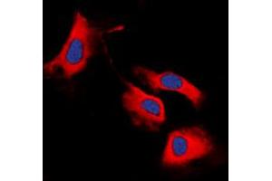 Immunofluorescent analysis of RET staining in MCF7 cells. (Ret Proto-Oncogene 抗体  (C-Term))