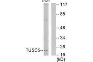 Western blot analysis of extracts from LOVO cells, using TUSC5 Antibody. (TUSC5 抗体  (AA 1-50))