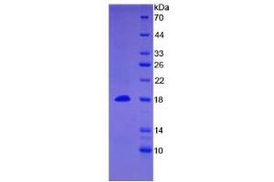 SDS-PAGE analysis of Human BMP15 Protein. (BMP15 蛋白)