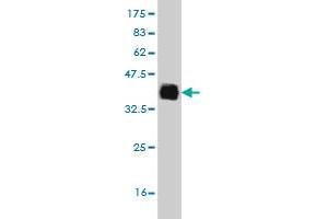 Western Blot detection against Immunogen (34. (ELAC1 抗体  (AA 282-362))