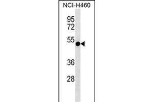 RTDR1 Antibody (N-term) (ABIN657164 and ABIN2846298) western blot analysis in NCI- cell line lysates (35 μg/lane). (RTDR1 抗体  (N-Term))