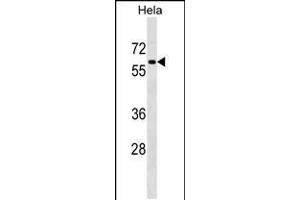Western blot analysis in Hela cell line lysates (35ug/lane). (PAF1/PD2 抗体  (C-Term))