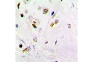 Immunohistochemistry (IHC) image for anti-Proteasome (Prosome, Macropain) Subunit, beta Type 10 (PSMB10) antibody (ABIN7306292)
