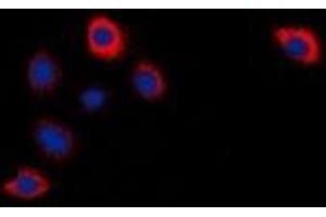 Immunofluorescent analysis of Cytochrome P450 2W1 staining in Hela cells. (CYP2W1 抗体)