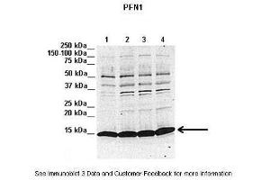 Lanes:   1. (PFN1 抗体  (N-Term))