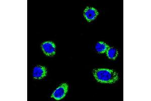 Confocal immunofluorescent analysis of B-RAF Antibody  f with Hela cell followed by Alexa Fluor 488-conjugated goat anti-rabbit lgG (green). (SNRPE 抗体  (AA 424-453))