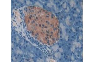 Used in DAB staining on fromalin fixed paraffin- embedded pancreas tissue (REG1A 抗体  (AA 10-165))