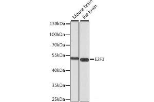 Western blot analysis of extracts of various cell lines using E2F3 Polyclonal Antibody at dilution of 1:1000. (E2F3 抗体)