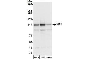 anti-Huntingtin Interacting Protein 1 (HIP1) (AA 987-1037) antibody