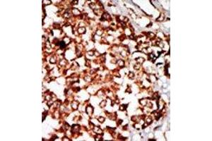 Image no. 1 for anti-Nuclear Receptor Binding Protein 1 (NRBP1) (N-Term) antibody (ABIN360550) (NRBP1 抗体  (N-Term))