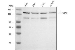 Western blot analysis of Symplekin/SYMPK using anti-Symplekin/SYMPK antibody (ABIN7601558).