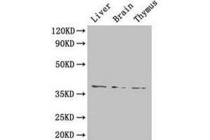 Western Blot Positive WB detected in: Mouse liver tissue, Mouse brain tissue, Mouse thymus tissue All lanes: HAVCR1 antibody at 4 μg/mL Secondary Goat polyclonal to rabbit IgG at 1/50000 dilution Predicted band size: 39 kDa Observed band size: 39 kDa (HAVCR1 抗体  (AA 21-290))