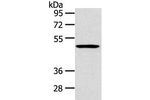 Western blot analysis of 231 cell using HTRA1 Polyclonal Antibody at dilution of 1:500 (HTRA1 抗体)