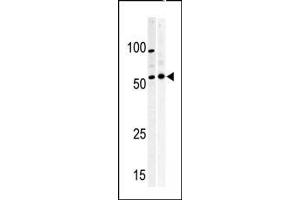 Western blot analysis of anti-PKMYT1 Pabin (left) and Y79 (right)cell line lysate. (PKMYT1 抗体  (C-Term))