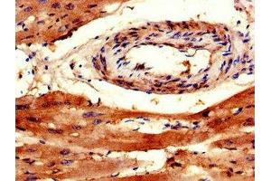 Immunohistochemistry of paraffin-embedded human heart tissue using ABIN7172377 at dilution of 1:100 (TRAPPC9 抗体  (AA 780-1030))