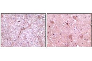 Immunohistochemical analysis of paraffin-embedded human cerebrum tissue (left) and myelencephalon tissue (right), showing cytoplasmic localization using Dynamin2 mouse mAb with DAB staining. (DNM2 抗体)