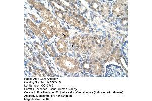 Rabbit Anti-GEM Antibody  Paraffin Embedded Tissue: Human Kidney Cellular Data: Epithelial cells of renal tubule Antibody Concentration: 4. (GEM 抗体  (C-Term))