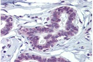 Human Breast (formalin-fixed, paraffin-embedded) stained with MAZ antibody ABIN462205 followed by biotinylated goat anti-rabbit IgG secondary antibody ABIN481713, alkaline phosphatase-streptavidin and chromogen. (MAZ 抗体  (N-Term))