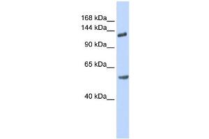 WB Suggested Anti-ROBO2 Antibody Titration: 0. (ROBO2 抗体  (N-Term))