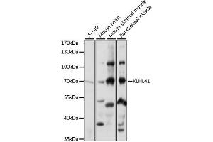 Western blot analysis of extracts of various cell lines, using KLHL41 antibody (ABIN6289966) at 1:1000 dilution. (Kelch-like protein 41 (KLHL41) 抗体)