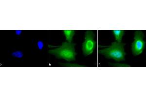 Immunocytochemistry (ICC) image for anti-Calreticulin (CALR) antibody (ABIN361835)
