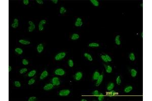 Immunofluorescence of monoclonal antibody to GOLPH4 on HeLa cell. (Golgi Integral Membrane Protein 4 (GOLIM4) (AA 473-568) 抗体)