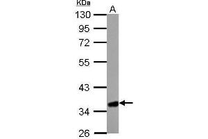 Western Blotting (WB) image for anti-3-Hydroxymethyl-3-Methylglutaryl-CoA Lyase (HMGCL) (full length) antibody (ABIN2856650)
