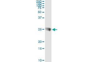 Western Blotting (WB) image for anti-Synaptosomal-Associated Protein, 23kDa (SNAP23) (AA 1-212) antibody (ABIN599065) (SNAP23 抗体  (AA 1-212))